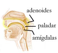 adenoides